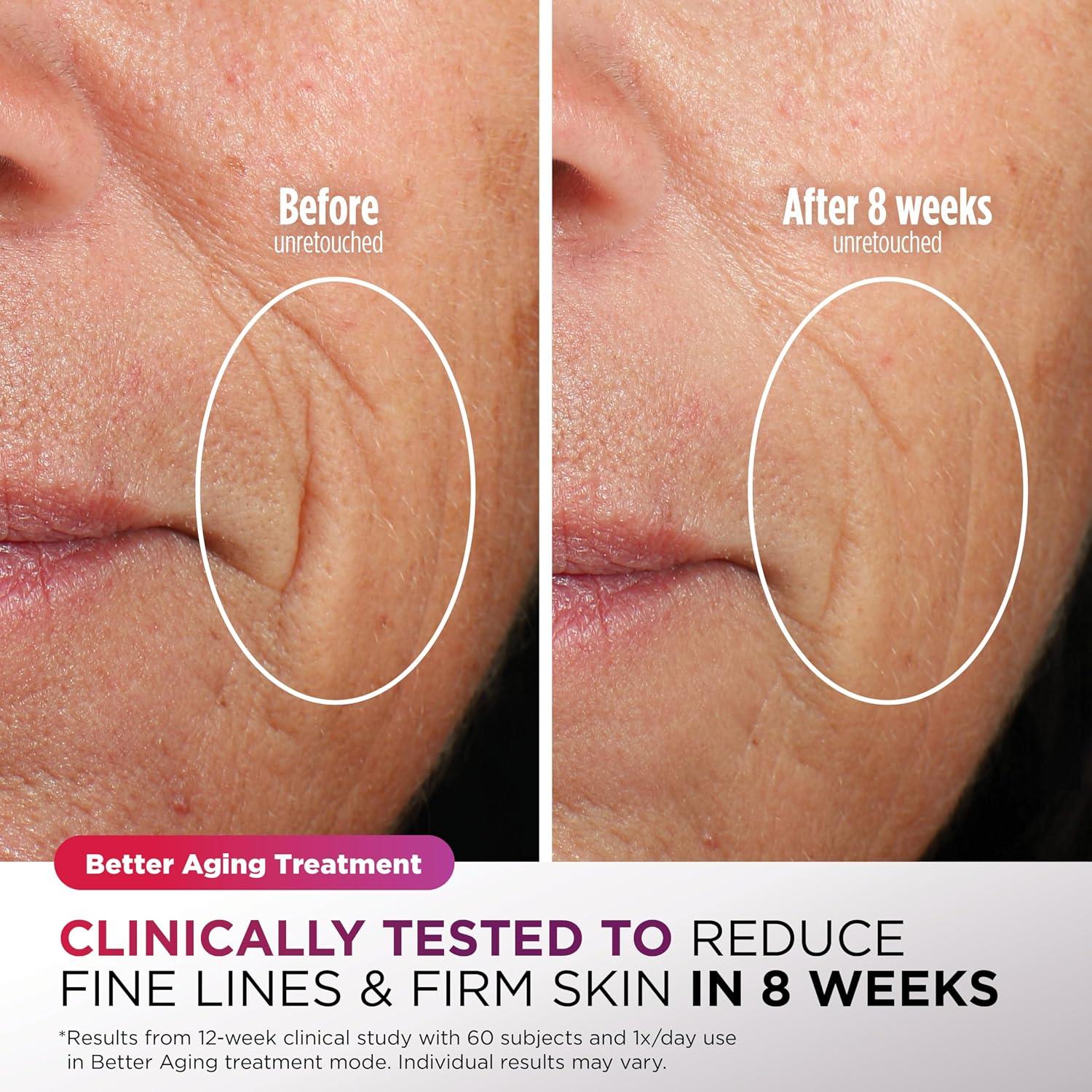 Mascarilla Facial LED Shark FW312LLA Antiedad Crioterapia — imagen 5